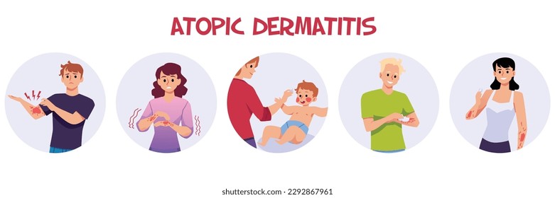 Set of people with atopic dermatitis flat style, vector illustration isolated on white background. Adults and kid, red spots on irritated skin, health and medicine, design elements