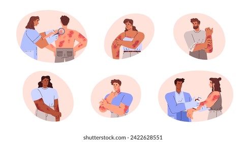 Set of people suffering from skin diseases and scratching. Men and women with psoriasis, dermatitis and eczema. Medical treatment to patient with dermatological problems. Vector illustration