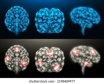 Conjunto de ilustraciones vectoriales poligonales de un cerebro sano y un cerebro enfermo con focos de inflamación. Banner médico del sistema nervioso, plantilla o fondo.