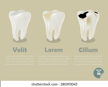 set of realistic tooth including healthy tooth and decayed tooth, dental health info graphics