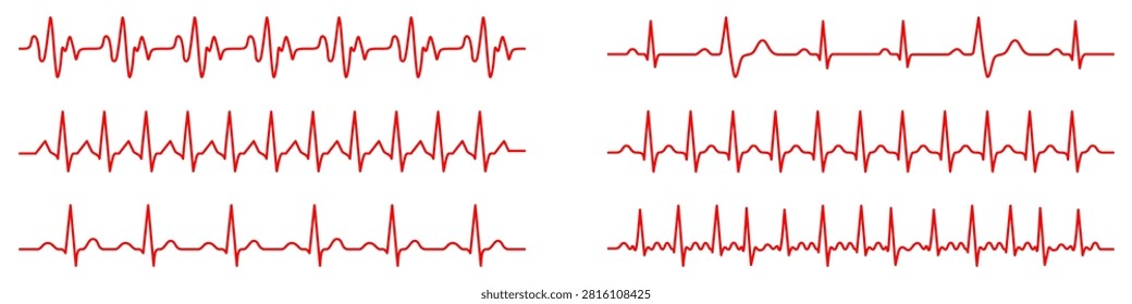 A set of red linear electrocardiogram graphs with different types of heart rhythms.