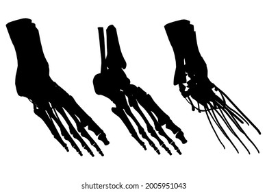 Set of silhouettes human leg skeleton with muscles isolated on white background. Vector illustration