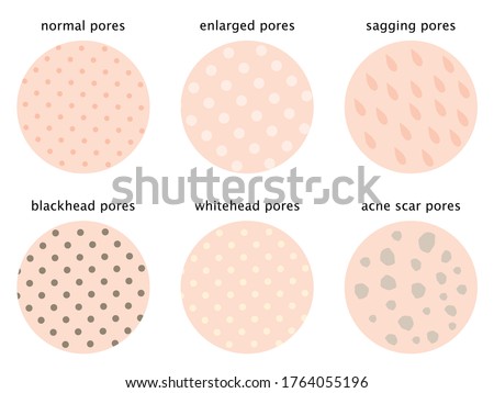 set of skin surface of pores, normal, sagging, open, blackhead, whitehead, and acne scar. Beauty skin care concept