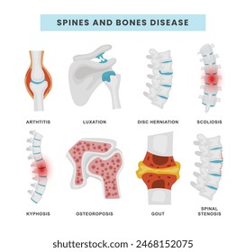 Set of spine and bone disease collection with arthritist, luxation, disc herniation, scoliosis, kyphosis, osteoporosis, gout, spinal stenosis. educational scheme with healthy and abdominal backbone.