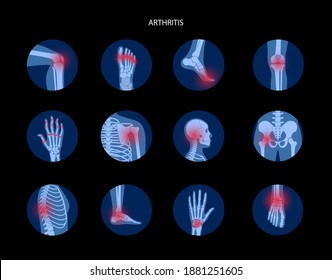 Set with spine, knee, wrist and other joint icons for clinic. Pain in the human body, anatomical logo concept. Arthritis, inflammation, bone disease medical poster or banner. Flat vector illustration.