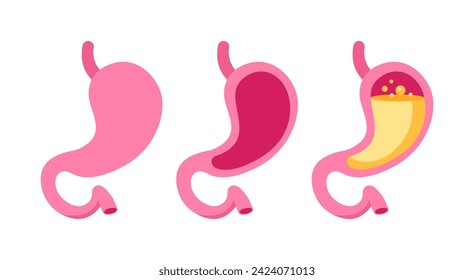 Set of stylized stomach icons in shades of pink, depicting various states of stomach health and conditions
