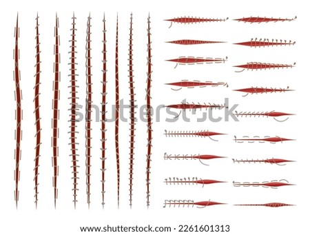 Set of surgical sutures. First aid injury stitch, medical stitches scars and wounds cartoon vector illustration