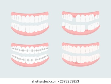 Juego de dientes. Problemas y llaves. Medicina y atención de la salud, tratamiento. Higiene y corrección bucal. Odontología y estomatología. Colección vectorial plana de dibujos animados aislada en fondo gris