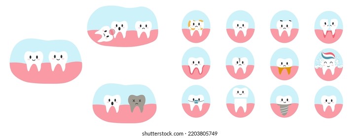 Set of teeth characters in cartoon flat style. Vector illustration of various dental diseases and tooth condition, as caries, crack, split, gingivitis, implant, wisdom tooth for brochure, banner