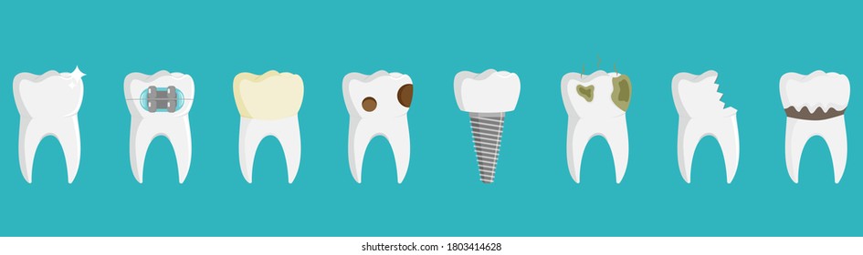 Set of teeth, healthy and witn different dental problems, stock vector illustration.