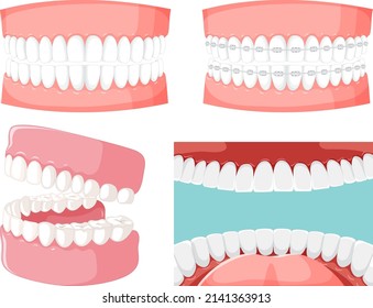 Set Of Teeth Inside Human Mouth With Human Teeth Model Illustration