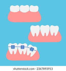 A set of teeth on a blue background. The concept of dental health. Dentistry icons. Vector. Flat style