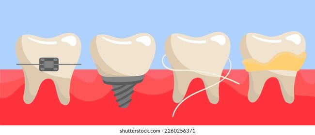 A set of teeth on the gums with braces, a false tooth, clean with dental floss, with tartar and plaque. The teeth are different on the gums. Illustration in a flat style