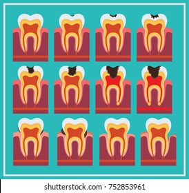Set of teeth for training. Teeth. Set of teeth.