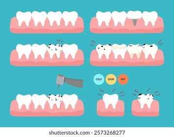 A set of teeth with various dental problems - caries, toothache, plaque, cracks, implant replacement, sensitivity. Vector hand-drawn illustration in flat style. Dental treatment, oral hygiene concept.