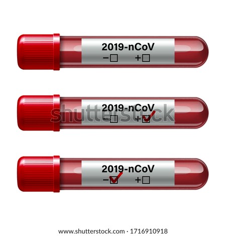 Set of test tube with blood sample for COVID-19, Coronavirus test. Positive and negative test result Coronavirus Covid-19. Vector illustration.