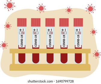 Set of test tubes with blood with positive and negative results for coronavirus. Medicine and health concept. Flat vector illustration.