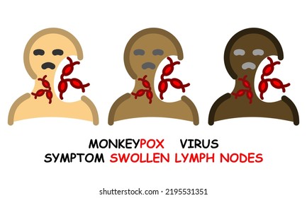 Set Of Three Monkeypox Symptoms Icons. Flat Icon With Outline Icon Symptom Of Swollen Lymph Nodes Monkeypox. Icons Of Different Skin Tones.