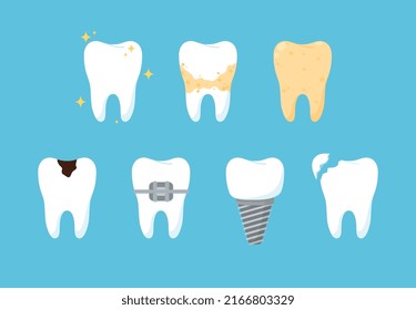 Set of tooth with caries, implant, dentures. Care, hygiene, dental treatment, vector flat illustration on blue background. Dental procedures with tooth, healthy tooth.