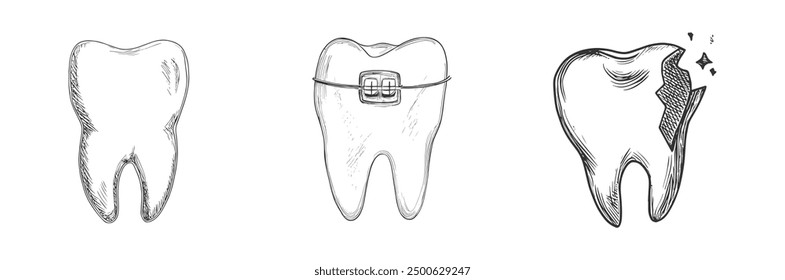 Set of Tooth Types: Regular, with Braces, and Chipped, Hand-Drawn Vector, Graphic Style, Cartoon Illustration, Black and White, Sketch Style, Isolated on White Background