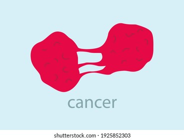Conjunto de células de cáncer de tumor que atacan células humanas con fondo azul. patógeno, virus, tumor. Ilustración vectorial.