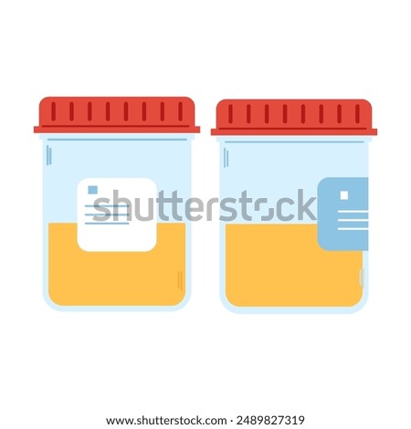 Set of two medical tubes with urine samples. Laboratory container. Pee sample in plastic containers
