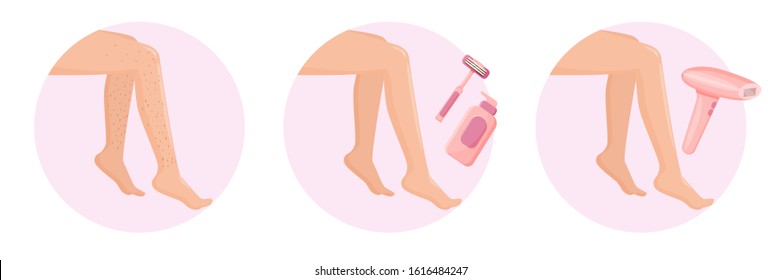Set of types of epilation and depilation of legs. Razor hair removal and laser hair removal beauty salon, procedures set.