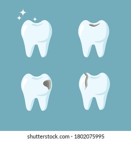 Set of various molars teeth isolated on blue background. Vector flat cartoon illustration. Dental health concept. Oral care, dental diseases. Design for dental, dentist or stomatology clinic