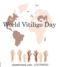 set with various people with vitiligo disease associated with world vitiligo day