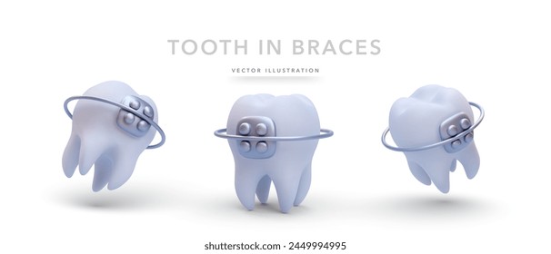 Set of various realistic teeth in 3D style isolated on white background. Vector illustration 