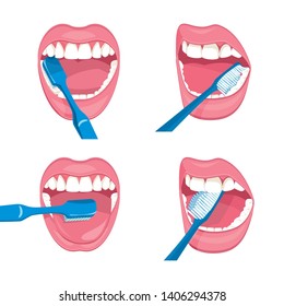 Set of Vector mouth on a white background . brushing teeth blue brush. instructions how to properly care for the oral cavity. 