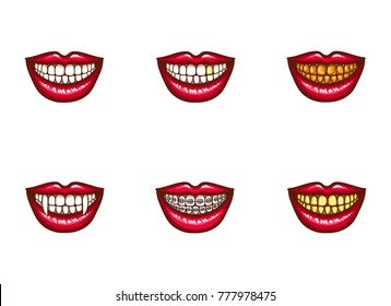 Gold Teeth Mouth Images Stock Photos Vectors Shutterstock