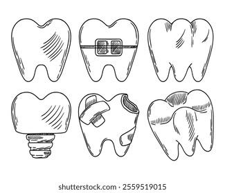 Set of vector teeth. Sketch of a tooth for prosthetics, a tooth with a brace, a molar, a tooth with caries. Dental treatment, dentistry, orthodontics. Vector illustration