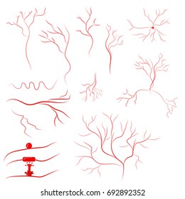 Set of vessels and aneurysms. Vector illustration.