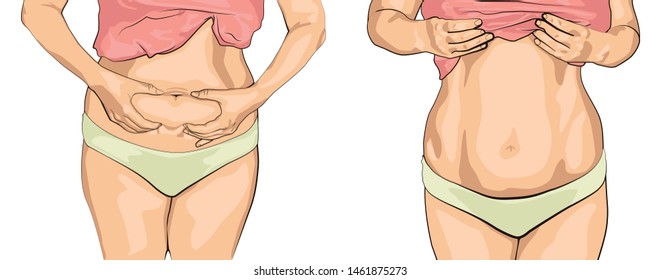 set women with fat belly.