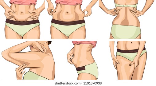 set women with fat belly. The girl clamps the fold of the belly with both hands. Female hands touching her fat on body. Women with a fat waist, hands, Legs. Female hands touching her body