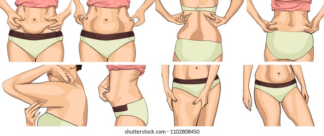 set women with fat belly. The girl clamps the fold of the belly with both hands. Female hands touching her fat on body. Women with a fat waist, hands, Legs. Female hands touching her body