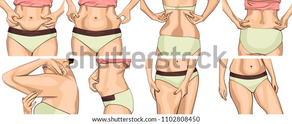 太った腹を持つ女性をセットする 女が両手で腹のたたみを締める 体の脂肪に触れる女性の手 太いウエスト 手 脚の女性 女性の手が彼女の体に触れる のベクター画像素材 ロイヤリティフリー