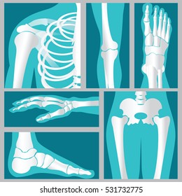 Set of xray of human, emblem or sign of medical diagnostic center ,flat vector illustration.