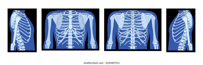 Set of X-Ray rib cage and hands Skeleton Human body Bones adult people roentgen front back side view. 3D realistic flat blue color Vector illustration of medical anatomy isolated on black background