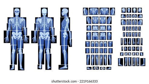 Set X  Ray Skeleton Human body    hands  legs  chests  heads  vertebra  pelvis  Bones adult people roentgen front back side view  3D realistic flat blue color Vector illustration medical anatomy