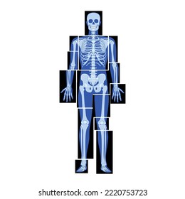 Set of X-Ray Skeleton Human body parts - hands, legs, chest, head, vertebrae pelvis, Bones adult people roentgen front view. 3D realistic flat blue color concept Vector illustration of medical anatomy