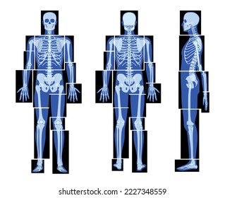 Set of X-Ray Skeleton Human body parts - hands, legs, chest, head, vertebra, pelvis, Bones adult people roentgen front back side view. 3D realistic flat concept Vector illustration of medical anatomy