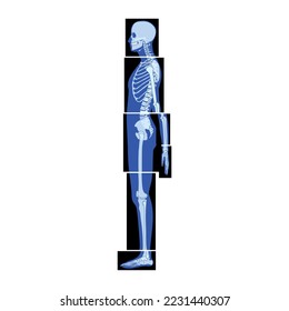 Set of X-Ray Skeleton Human body parts - hands, legs, chest, head, vertebra, pelvis, Bones adult people roentgen side view. 3D realistic flat blue color concept Vector illustration of medical anatomy