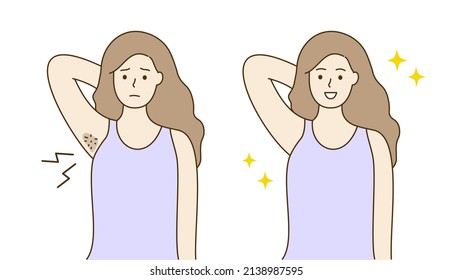 Set of Young woman with dark smelly hairy and smooth clean armpit. Beauty routine, laser innovation, hair removal, body skin care concepts. Hand drawn cartoon style vector before after illustrations. svg