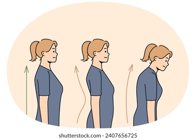 Set von jungen Frauen Haltungskorrektur. Kollektion von Frauen mit und ohne Rückenprobleme. Gesundheitswesen und Physiotherapie. Vektorgrafik.