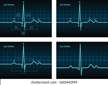 Sets Of Electrocardiogram ECG Or EKG Blue Heart Beat Signal Pulse Monitor Oscilloscope