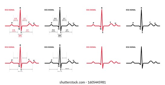 Sets Of Electrocardiogram ECG Or EKG Heart Beat Graph Signal Pulse Color And Black On White Background