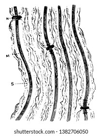 Several fibers of a bundle of medullated nerve fibers acted upon by silver nitrate to show peculiar behavior of nodes of Ranvier, vintage line drawing or engraving illustration.