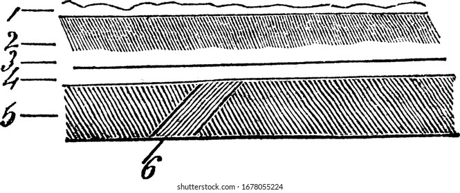 Several layers entering into the composition of the skin, it shows three different images of layer of skin init, vintage line drawing or engraving 